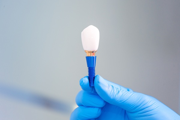 Can A General Dentist Repair A Dental Implant Restoration?