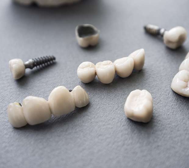 Palm Beach Gardens The Difference Between Dental Implants and Mini Dental Implants